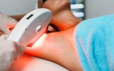 Quels résultats peut-on attendre d’une épilation laser à Villeurbanne après plusieurs séances ?