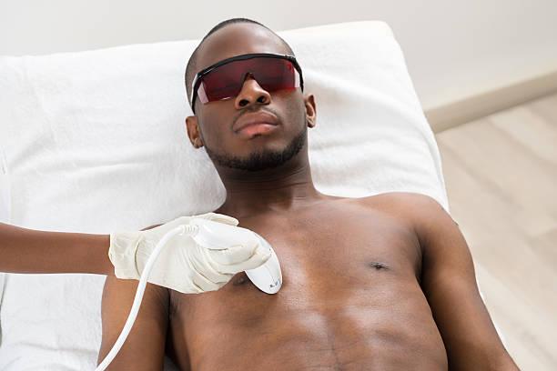 Therapist Giving Laser Epilation On Young African Man's Chest épilation laser à Villeurbanne